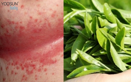 chữa hăm tã với lá chè xanh