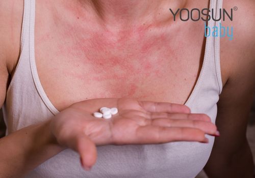 tại sao ăn cua ghẹ lại bị dị ứng