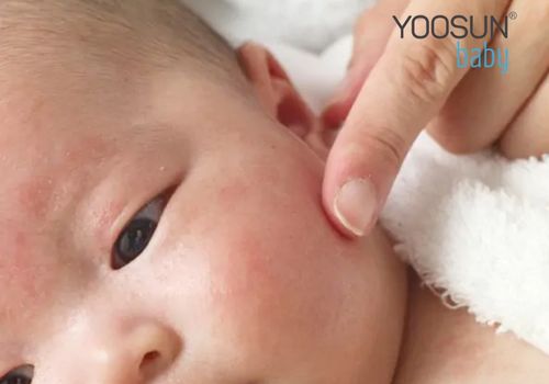 trẻ sơ sinh bị nổi mụn nước