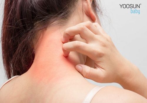cách chữa dị ứng kim loại